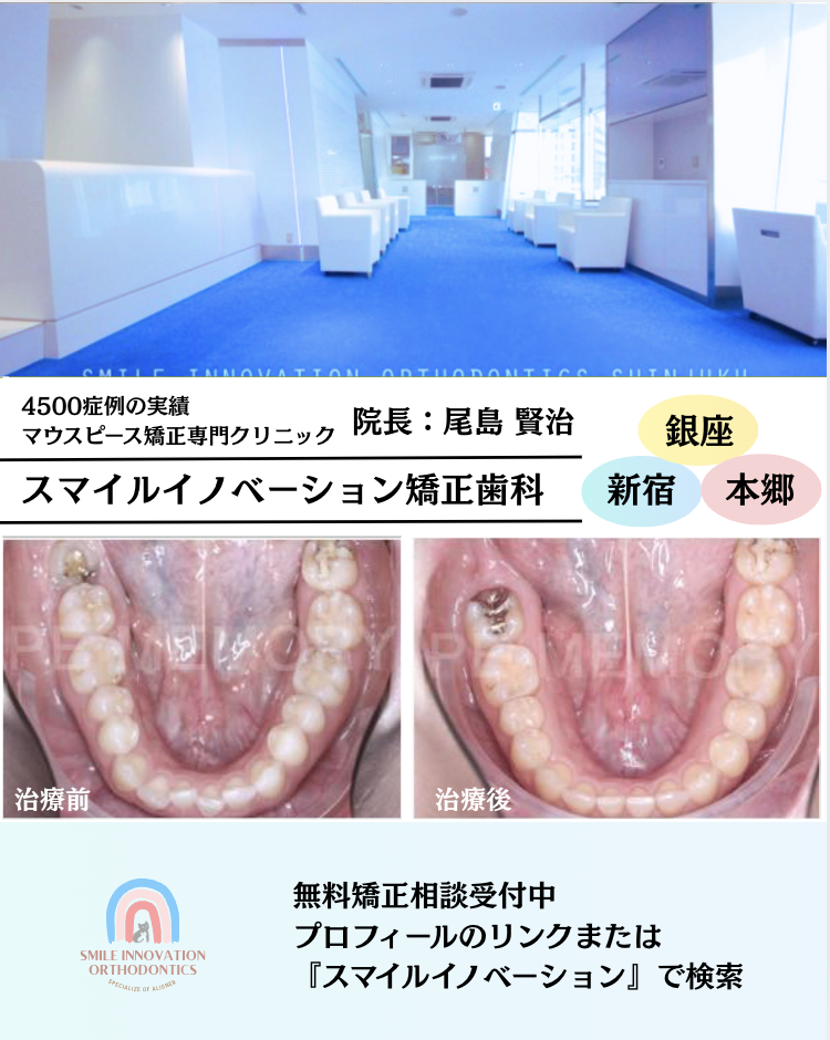 スクリーンショット 2025-05-13 11.38.03