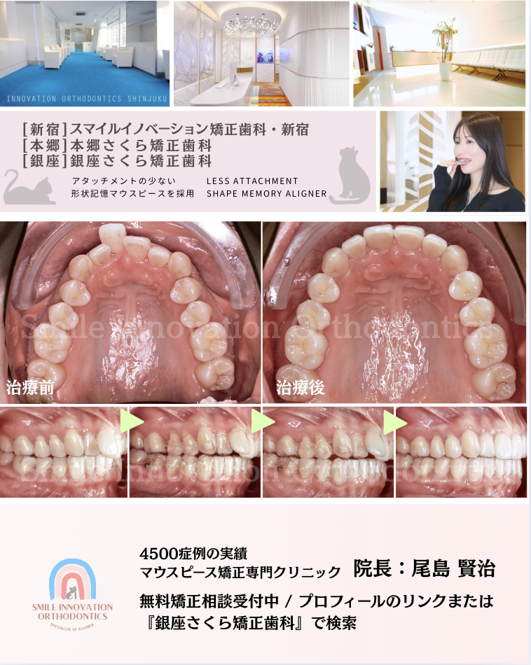 スクリーンショット 2025-11-10 12.16.17