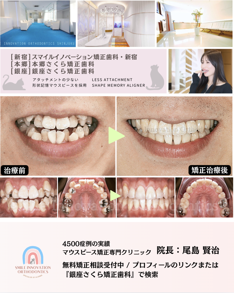 スクリーンショット 2026-02-25 16.33.46