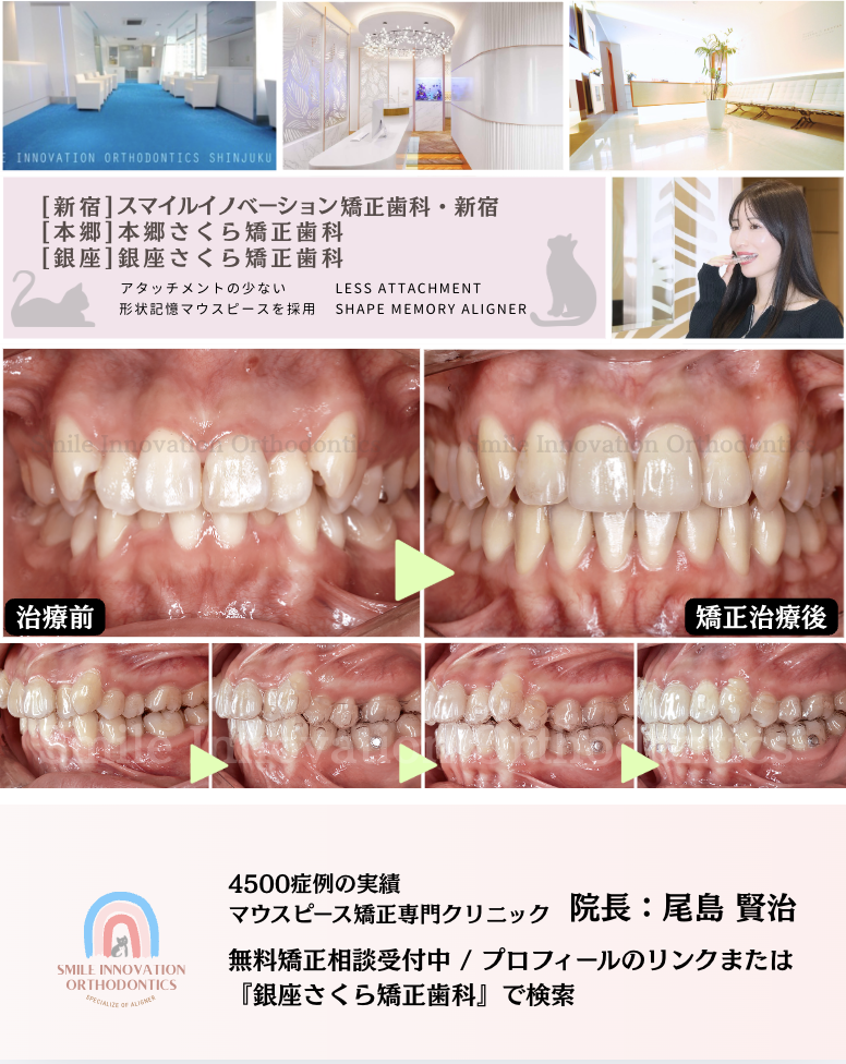 スクリーンショット 2026-02-17 14.51.17