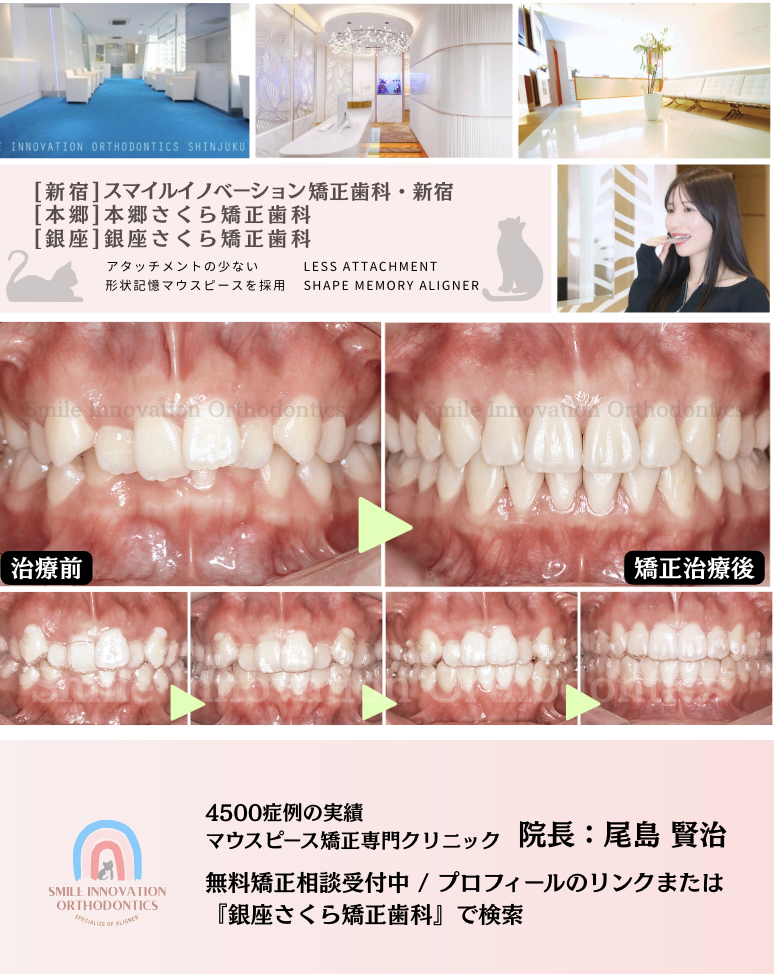 スクリーンショット 2026-02-18 12.50.25