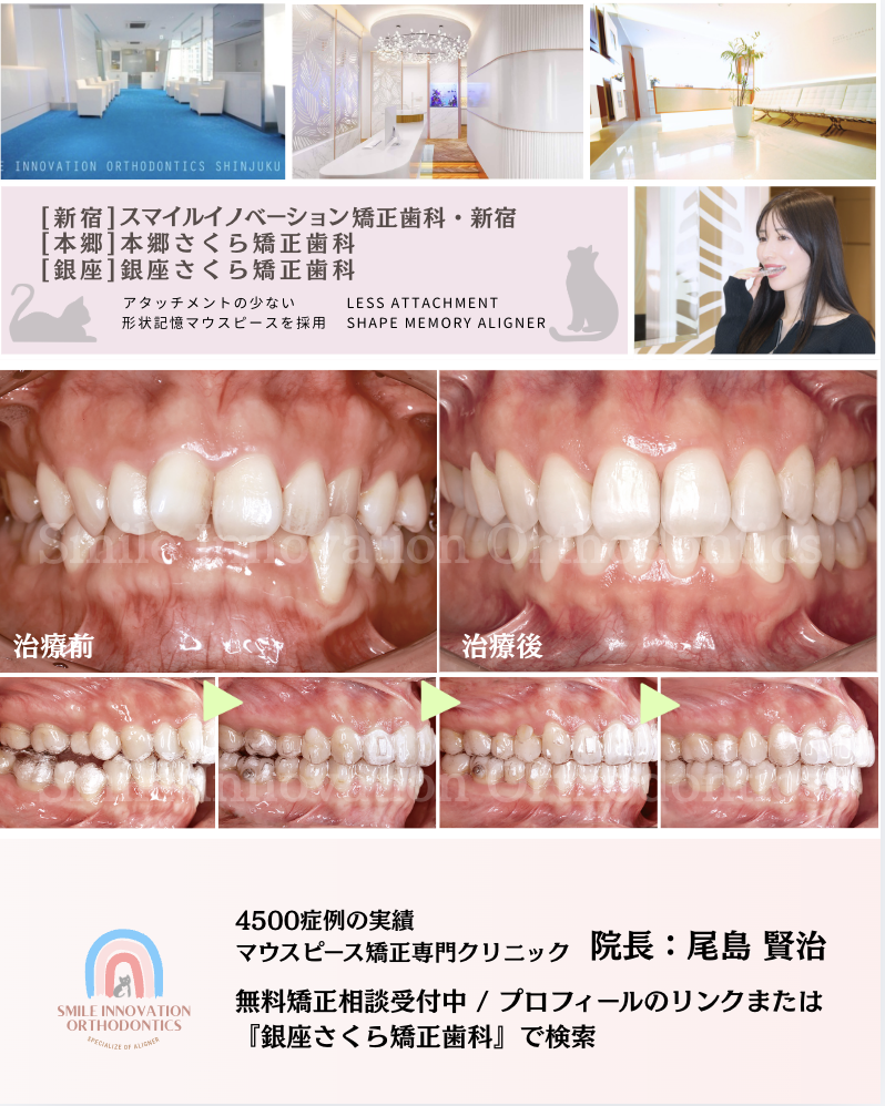 スクリーンショット 2026-03-17 18.43.30