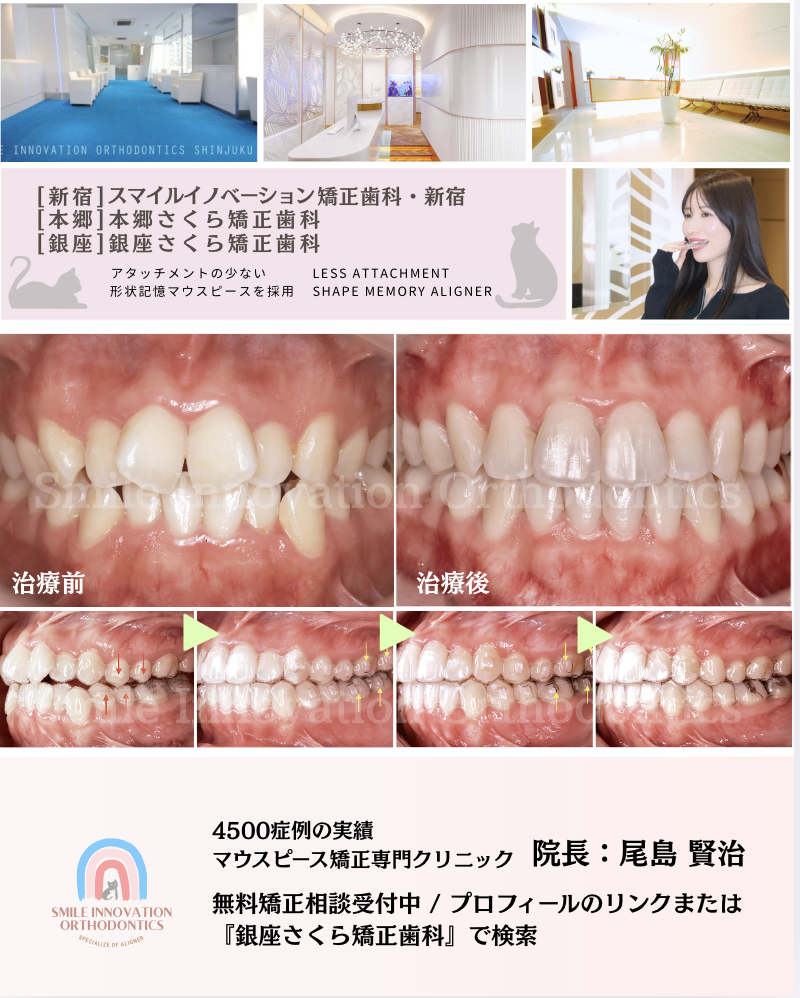 スクリーンショット 2026-03-17 18.48.50