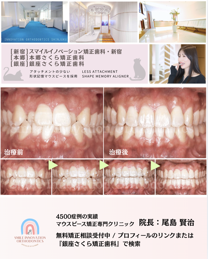 スクリーンショット 2026-03-17 18.51.51