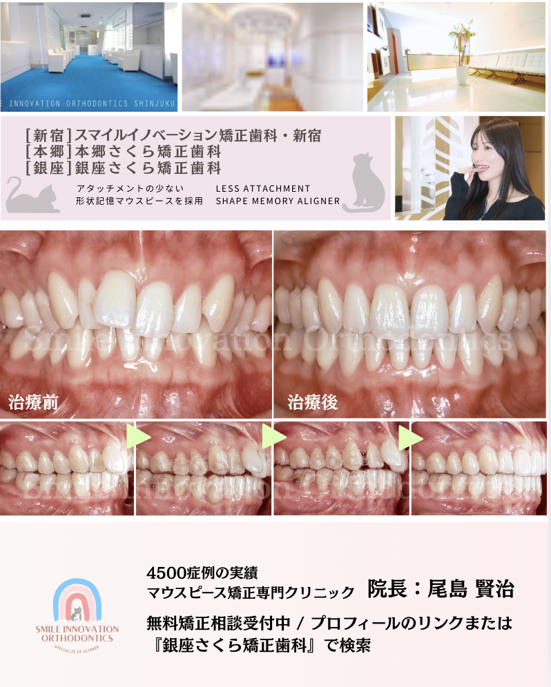 スクリーンショット 2026-03-21 13.48.51