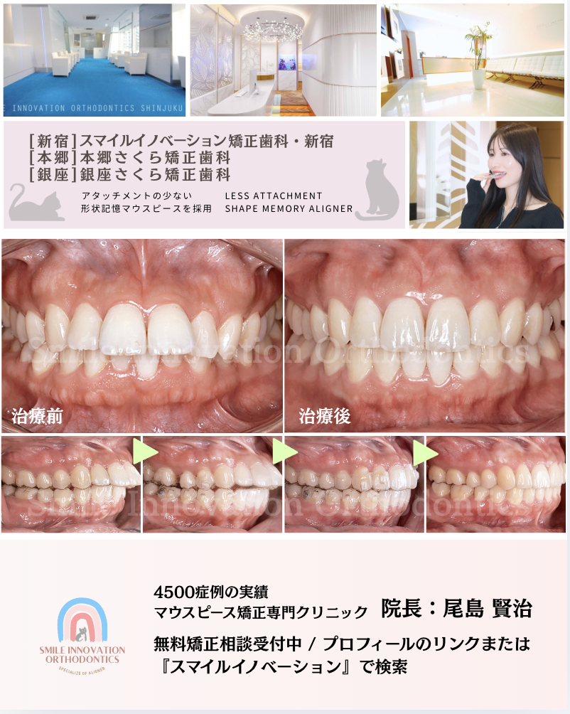 スクリーンショット 2026-03-17 18.38.28