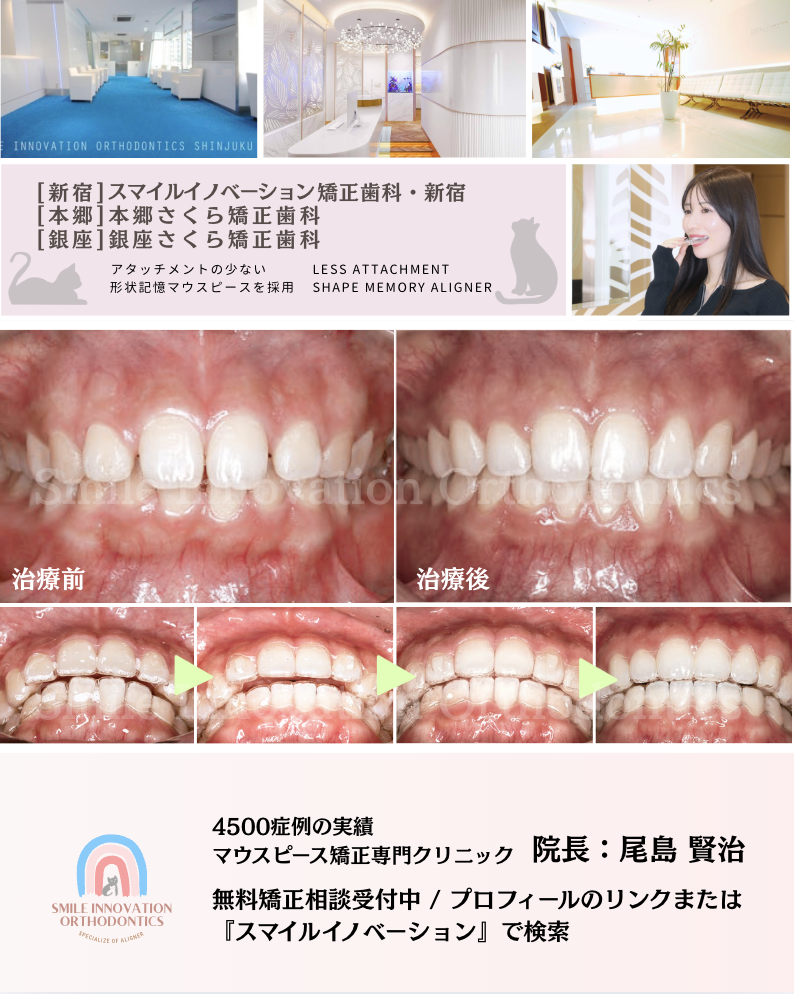 スクリーンショット 2026-03-17 18.36.03