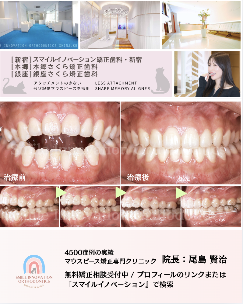 スクリーンショット 2026-03-17 18.40.39