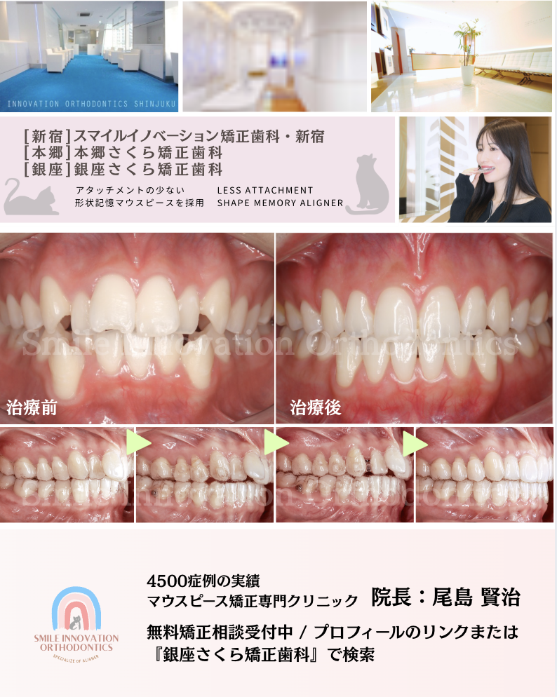 スクリーンショット 2026-03-21 13.51.07