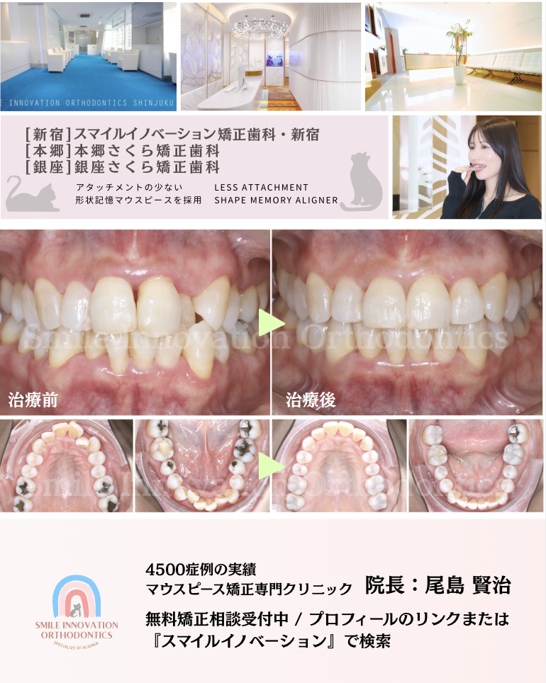 スクリーンショット 2026-03-13 10.31.26