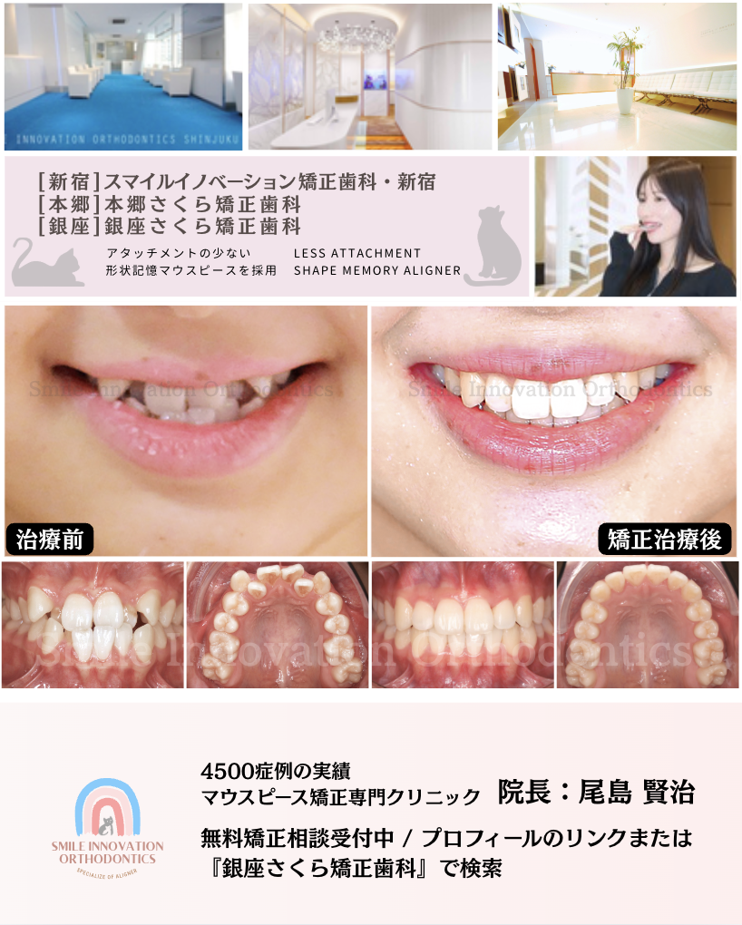 スクリーンショット 2026-04-21 20.35.32