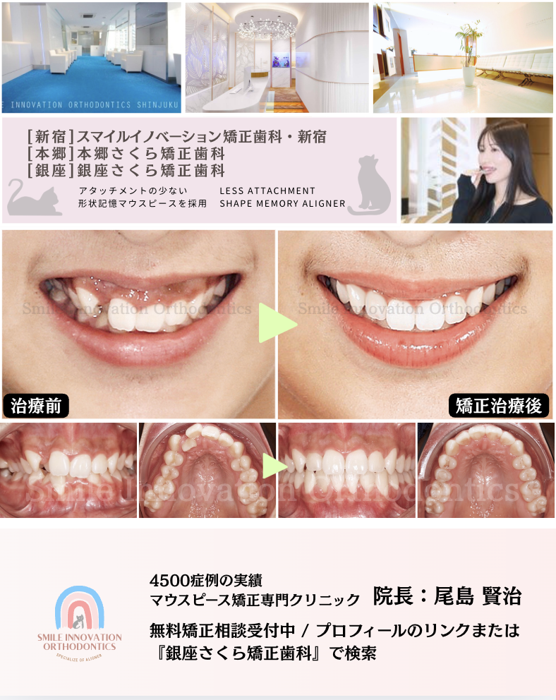 スクリーンショット 2026-04-13 16.17.51