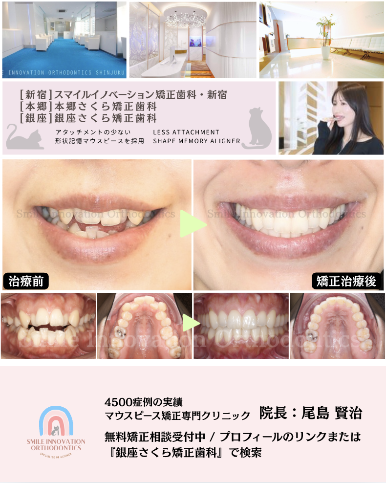 スクリーンショット 2026-04-15 12.34.18