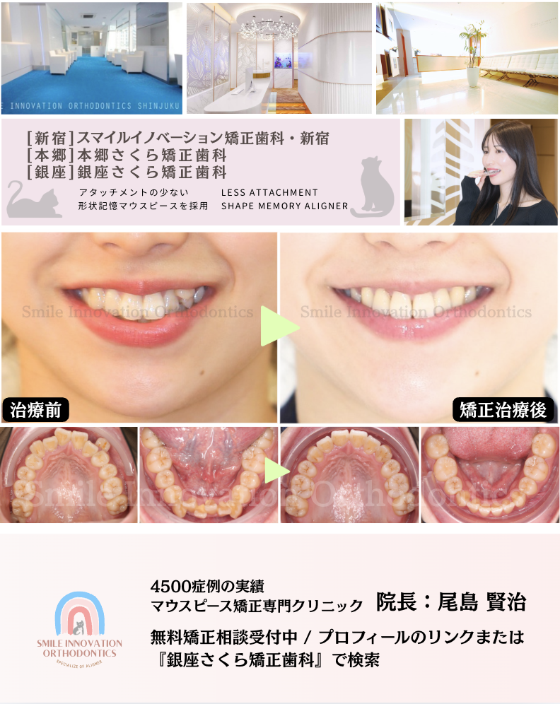 スクリーンショット 2026-04-08 15.44.51