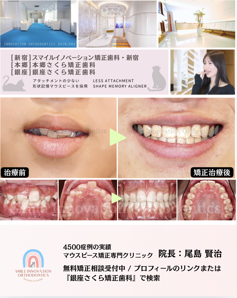 スクリーンショット 2026-04-13 16.20.25