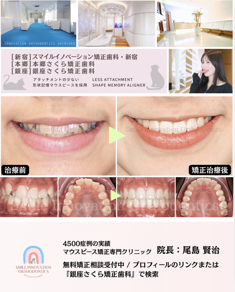 スクリーンショット 2026-04-08 15.52.10