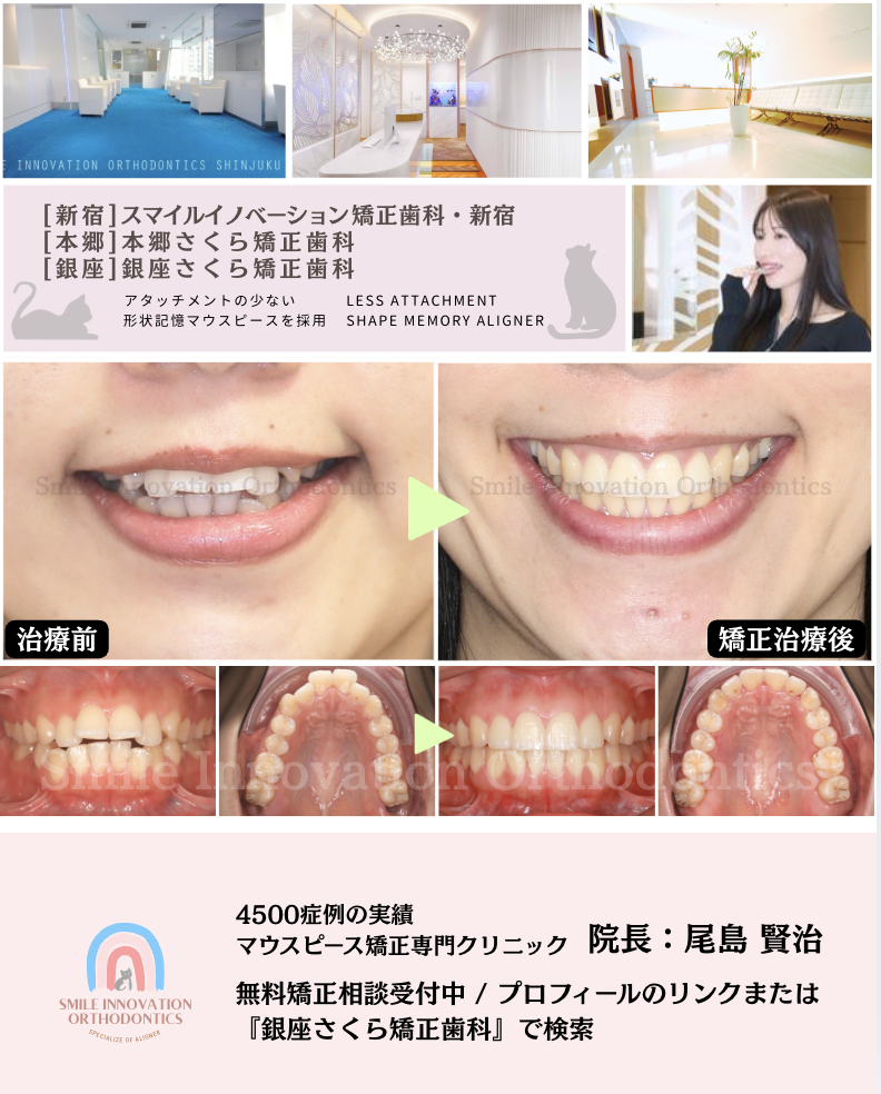 スクリーンショット 2026-04-15 11.55.30