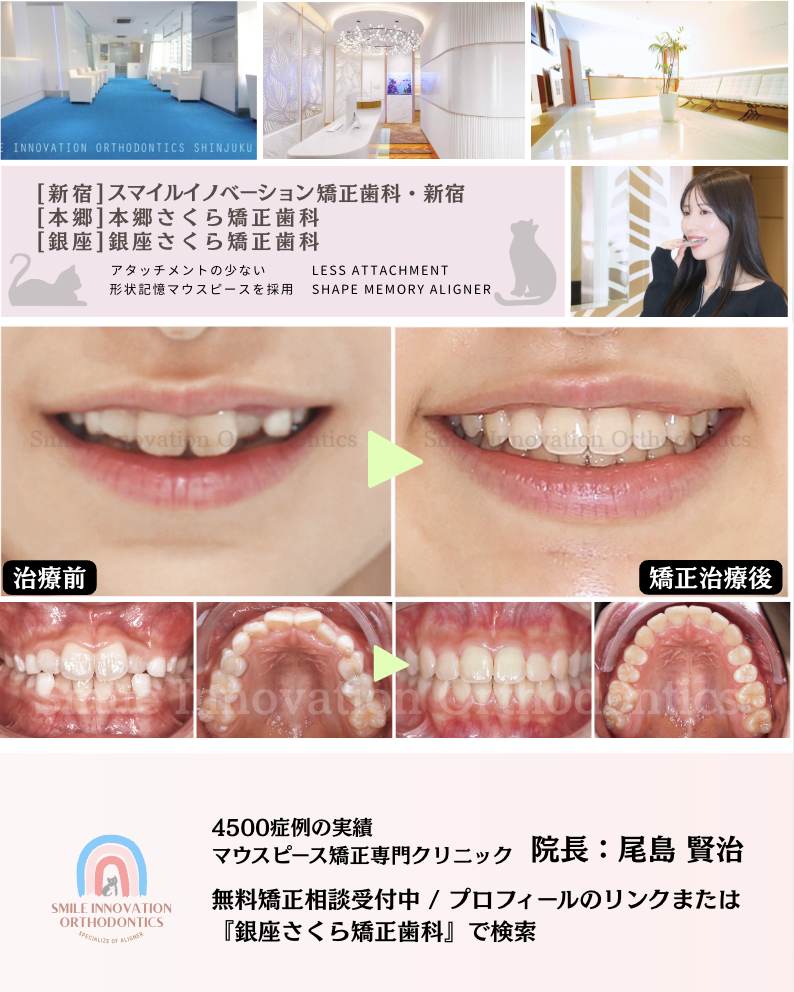 スクリーンショット 2026-04-06 12.37.13