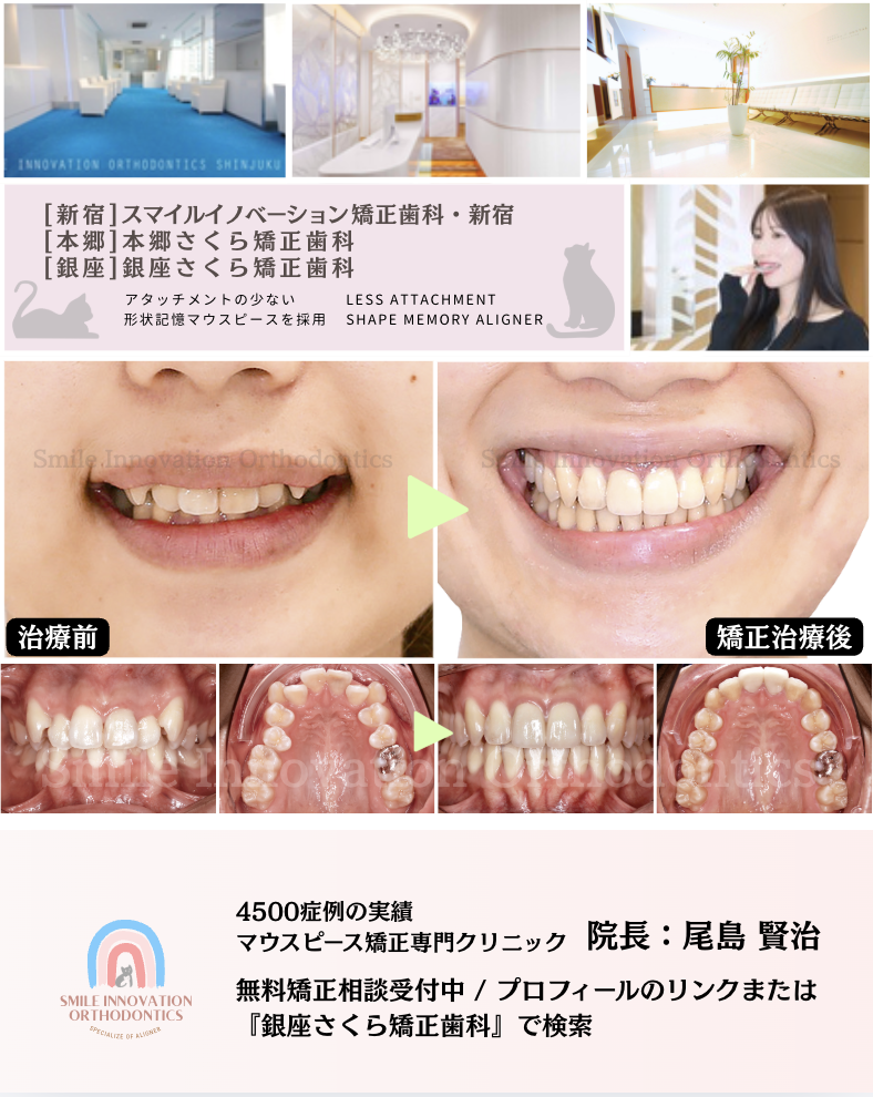 スクリーンショット 2026-04-21 11.02.02