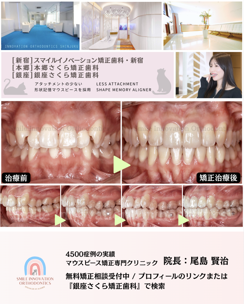 スクリーンショット 2026-05-12 12.17.58