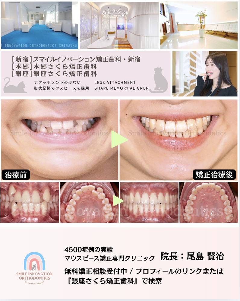 スクリーンショット 2026-05-15 14.44.06