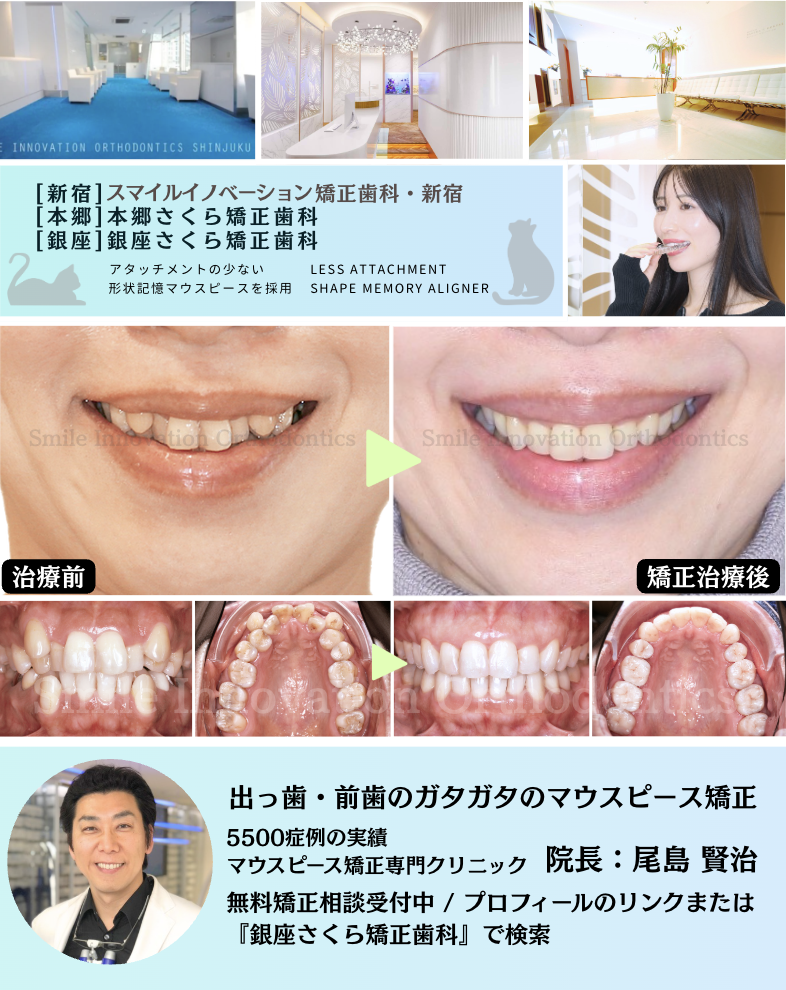 スクリーンショット 2026-05-21 11.50.59