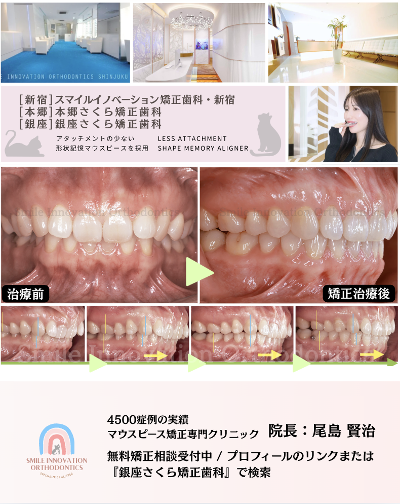 スクリーンショット 2026-05-11 10.08.24