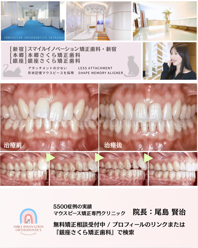 スクリーンショット 2026-06-29 10.35.15