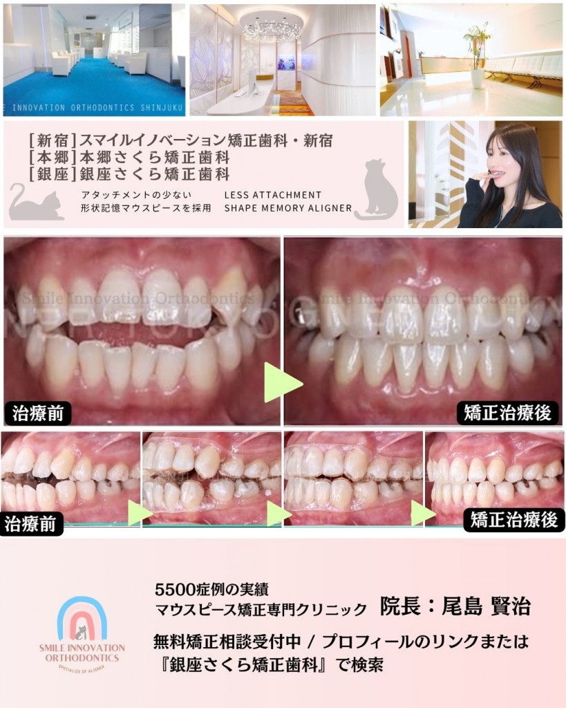 FB症例 (1)