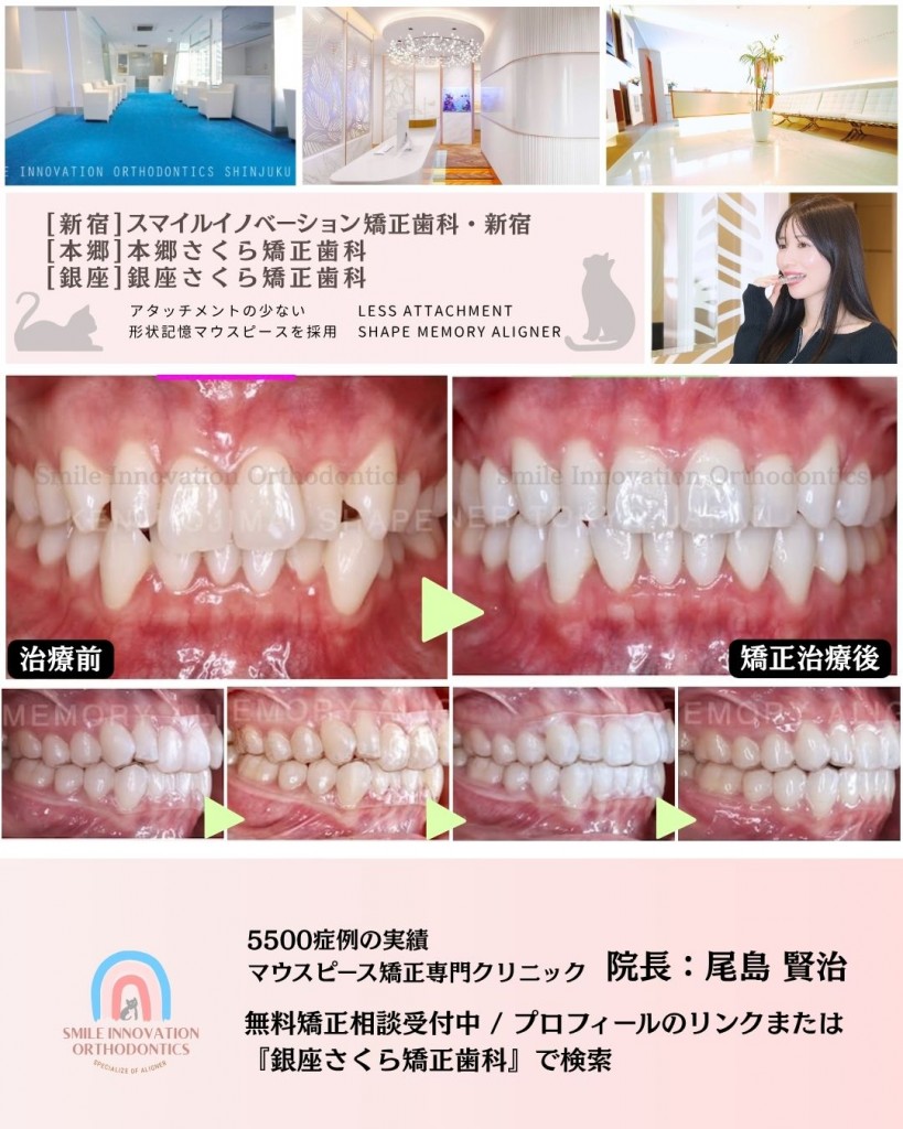 FB症例 (1)