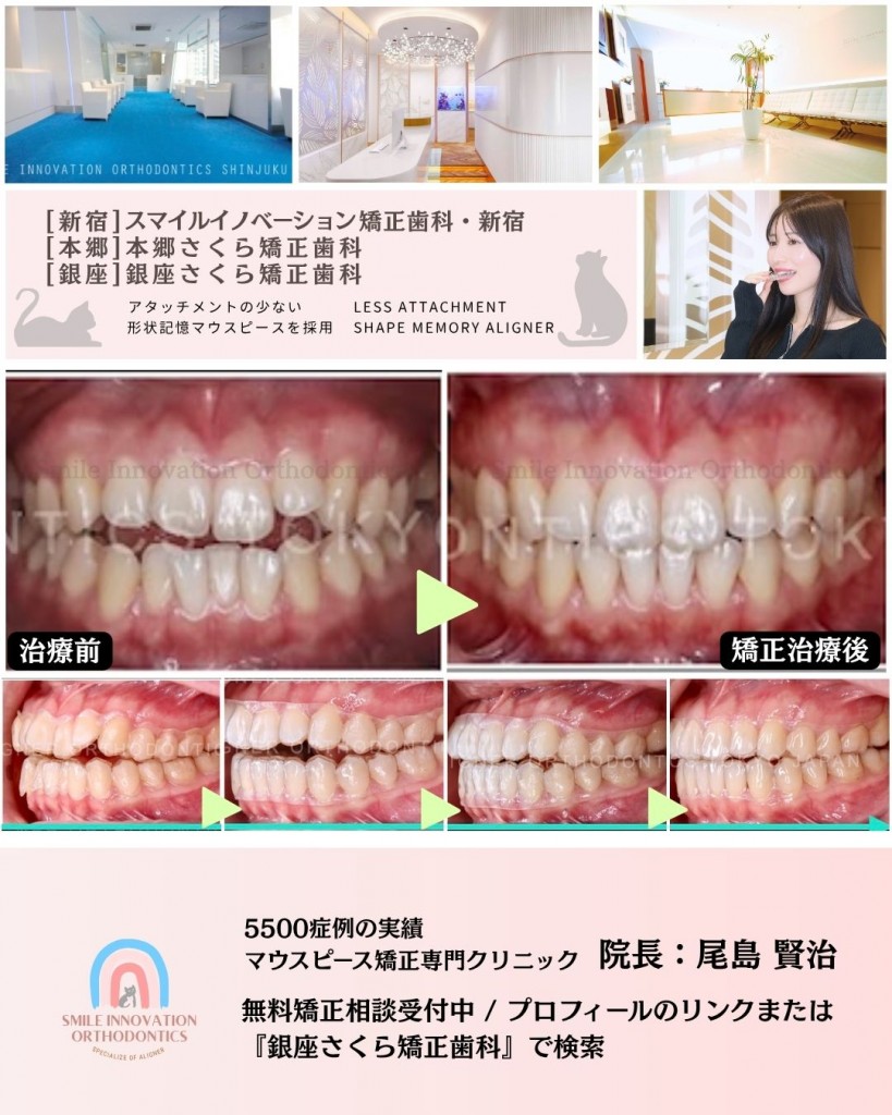 FB症例 (1)