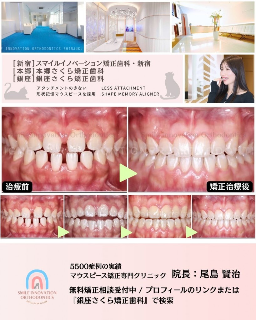FB症例 (1)