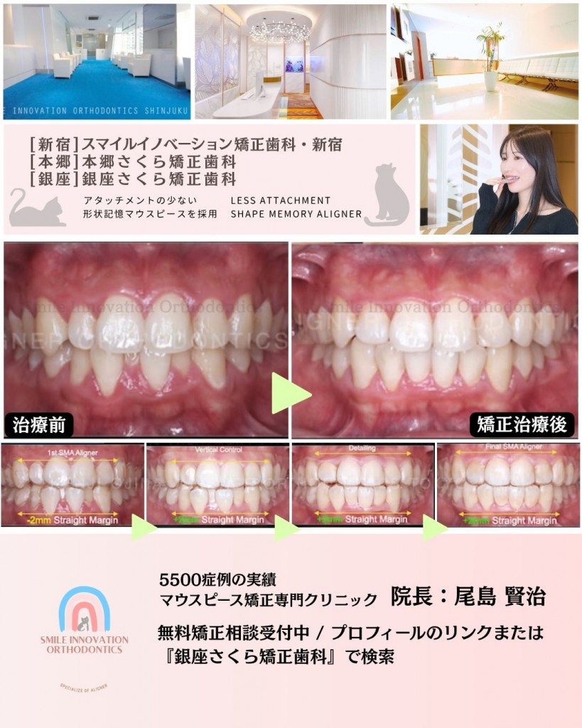FB症例 (1)