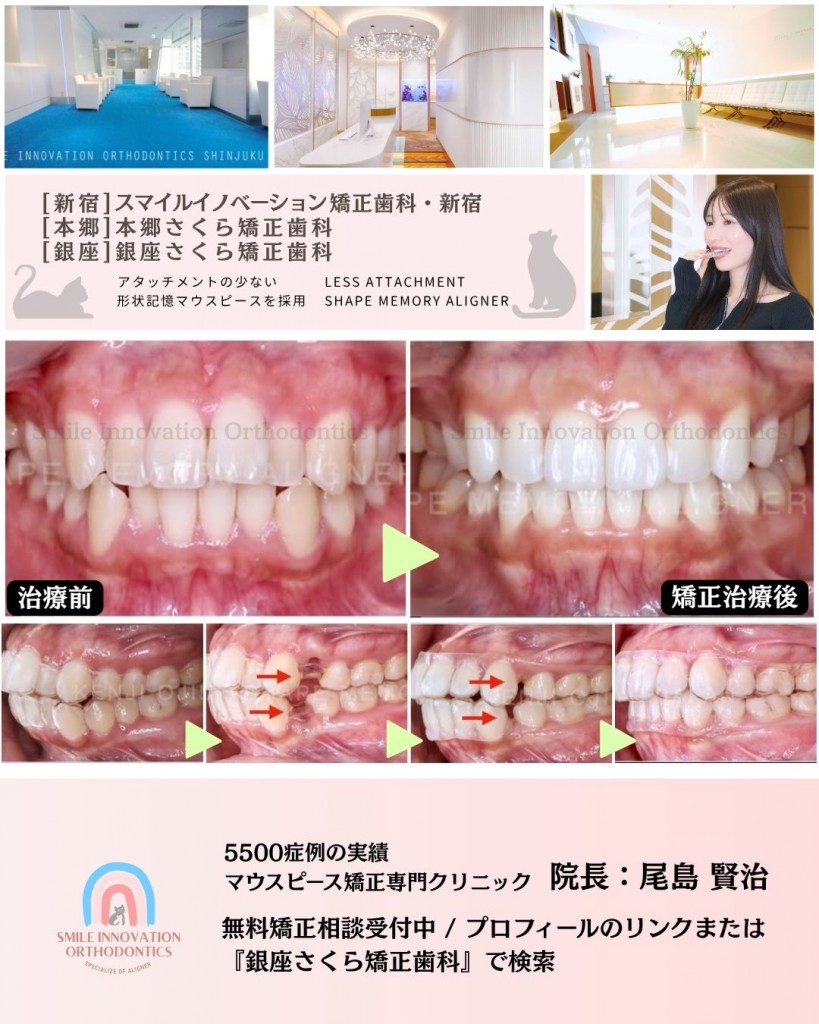 FB症例 (1)
